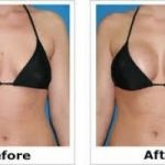 %%%HOW TO  ENLARGE HIPS AND BUMS + Botcho, BREAST  Skin Lightening Pills   QUICK RESULTS +27785167256%%%