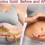 What does Biotox Gold UK do?