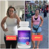 https://wintersupplement.com/keto-extreme-fat-burner-south-africa/